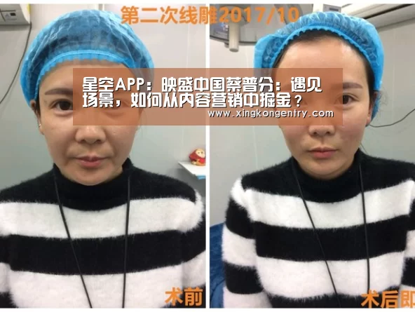 星空APP:映盛中国蔡普分:遇见场景,如何从内容营销中掘金?(图3) 星空APP